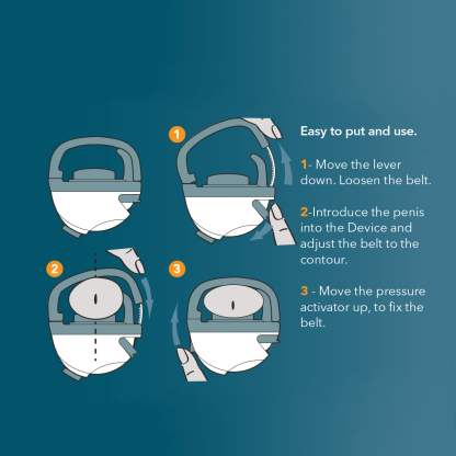 Harex Urinary Incontinence Medical Device - Image 4
