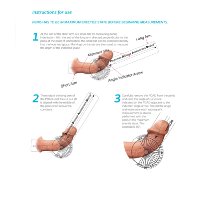 Peyronie's Disease Assessment Device - Image 2